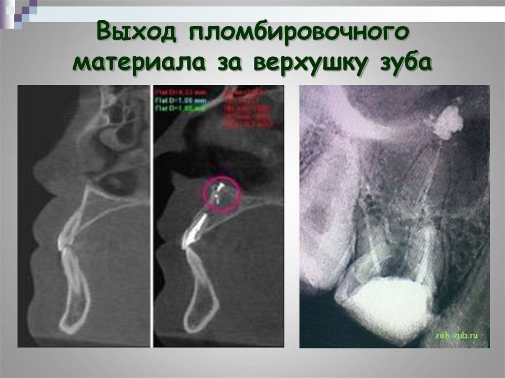 Лицевые боли неврология презентация