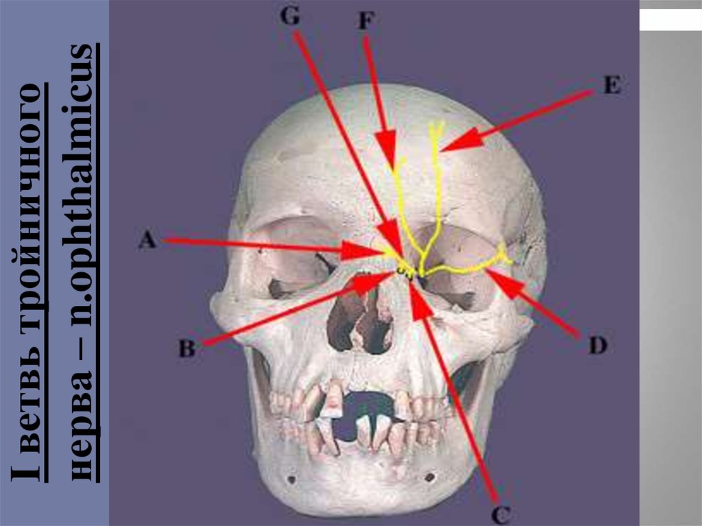 Лицевые боли. Нерв максилярис. Nervus infraorbitalis воспаление. N supraorbitalis. N ophthalmicus.