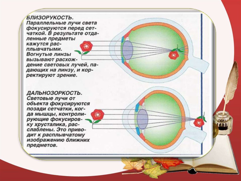 Изображение фокусируется перед сетчаткой