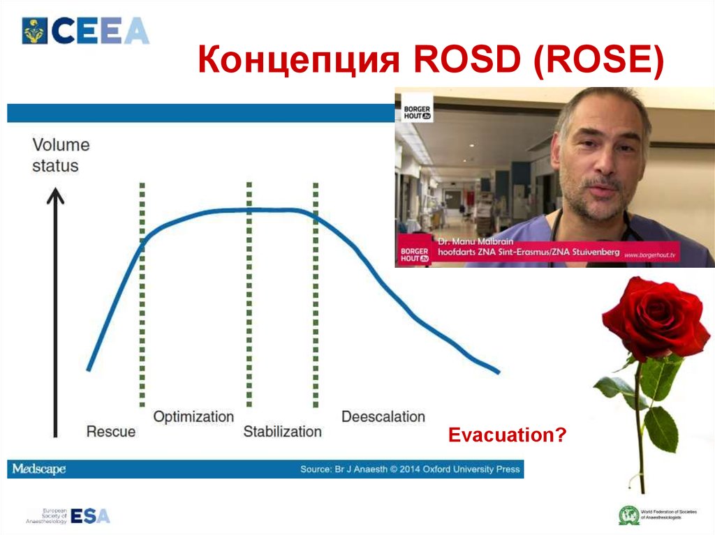 Концепция ROSD (ROSE)