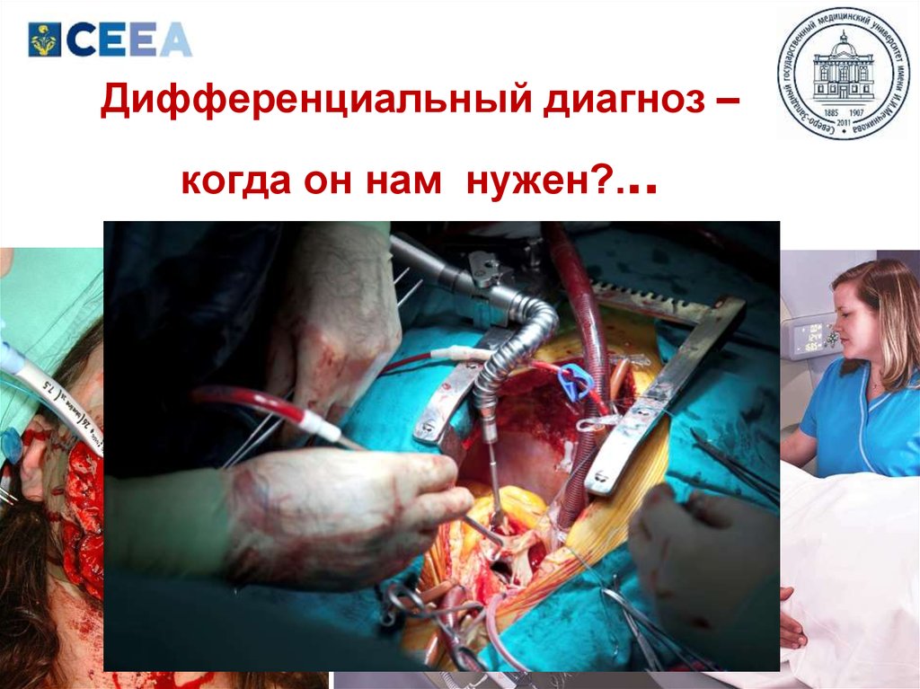Дифференциальный диагноз – когда он нам нужен?...