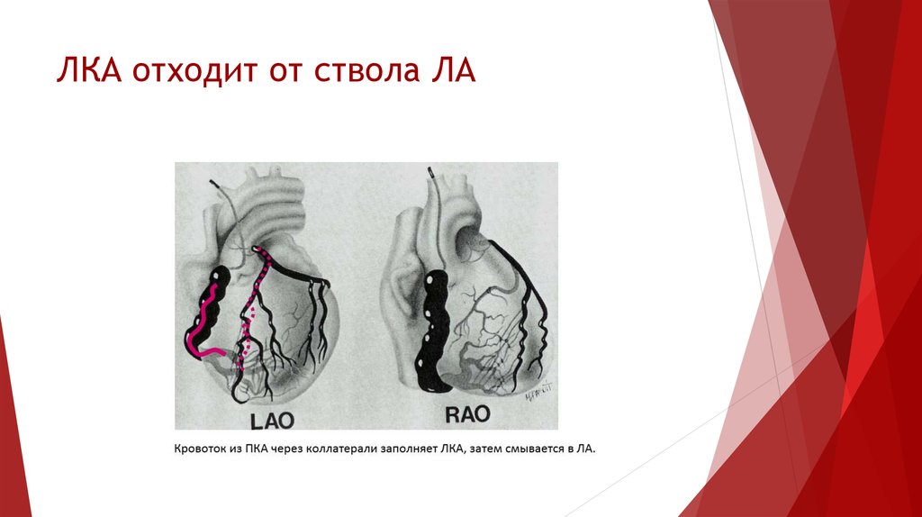 Боль в аорте сердца