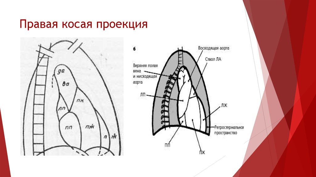 Прямая и боковая проекция