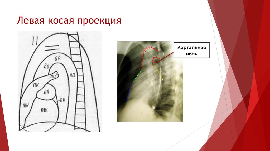 Правая проекция