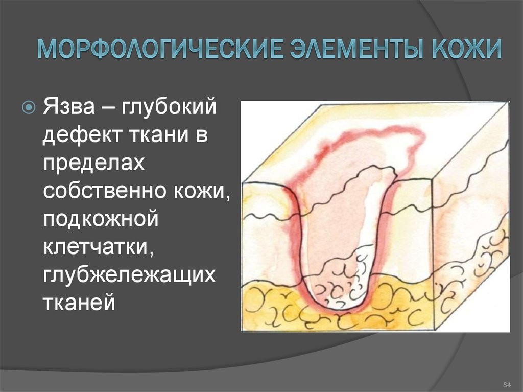 Первичные морфологические элементы кожи презентация - 88 фото