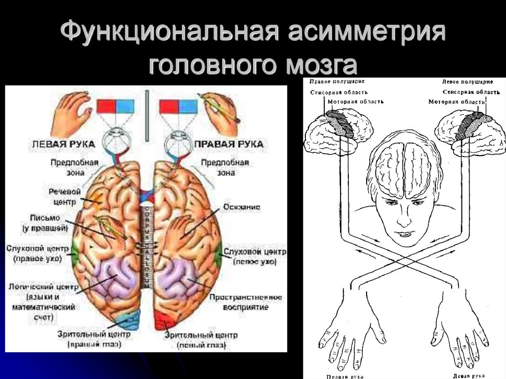 Развитие правого и левого полушарий. Анатомическая асимметрия коры головного мозга. Функциональная межполушарная асимметрия головного мозга это. Смешанный Тип функциональной асимметрии мозга. Функциональная асимметрия головного мозга человека.