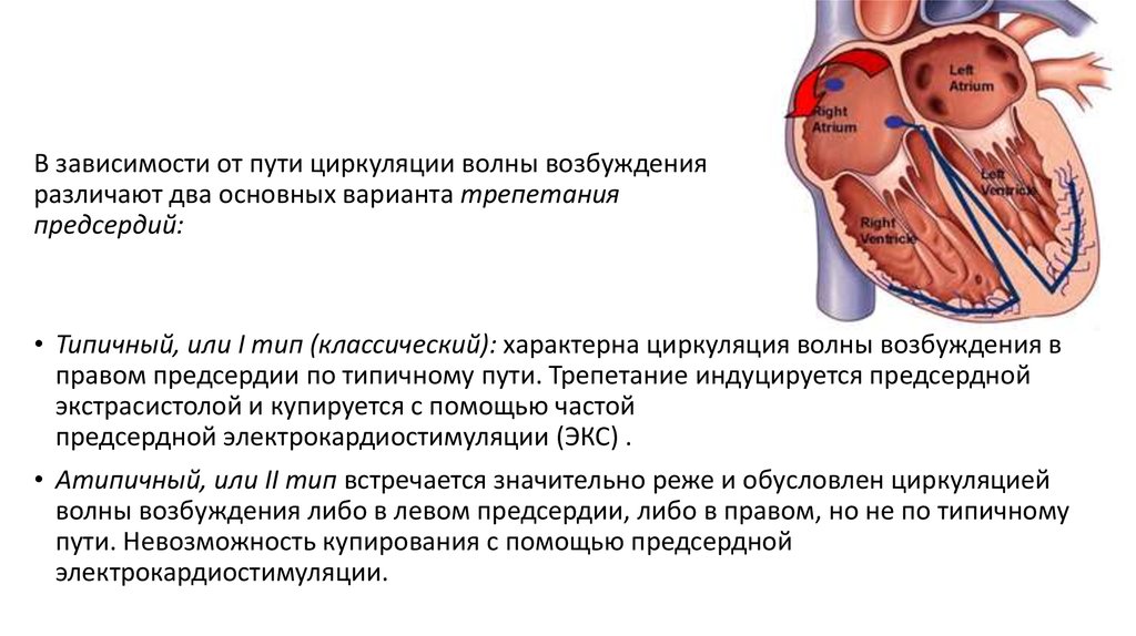 Волна возбуждения. Циркуляция волны возбуждения в миокарде. Циркулирующая волна возбуждения. Циркуляции возбуждения в правом предсердии при типичном трепетании. Круговая волна возбуждения.