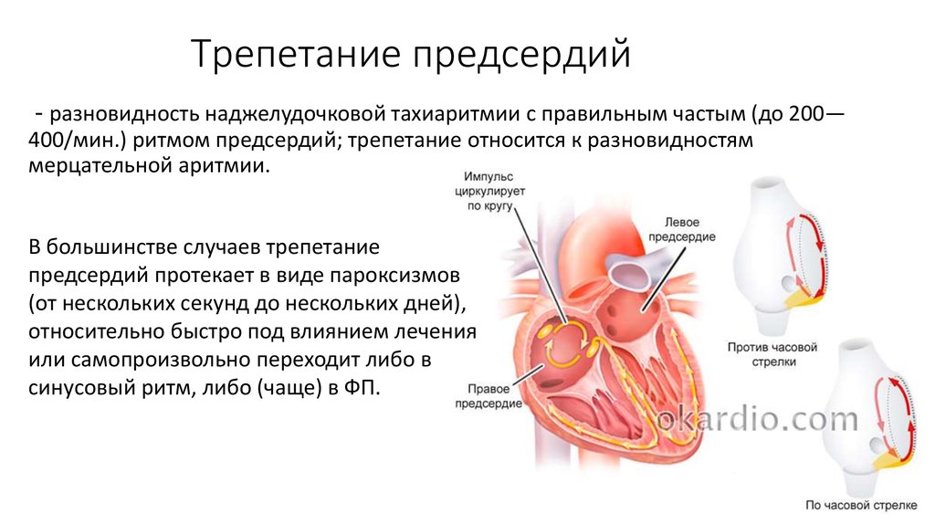 Пароксизм предсердия лечение