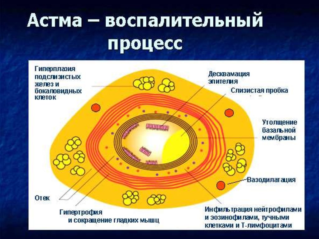 Респираторные аллергозы презентация