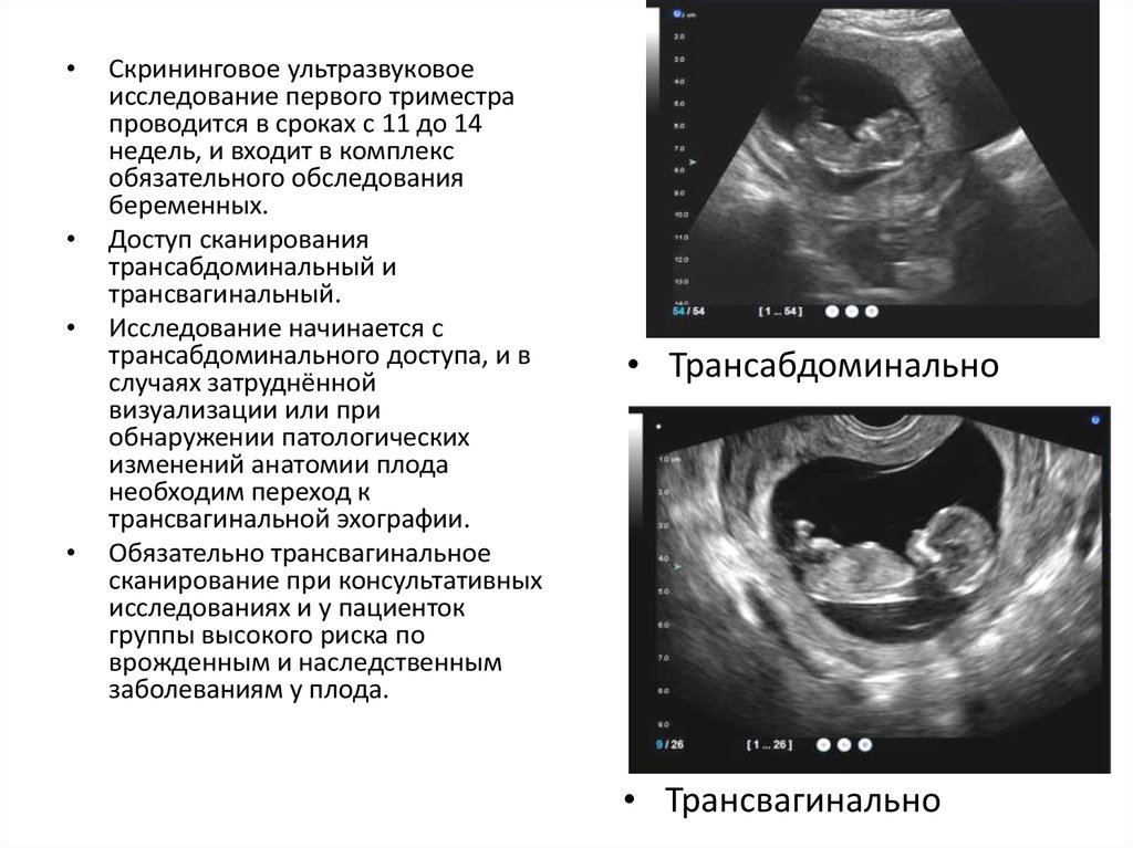 Диагностика беременности презентация