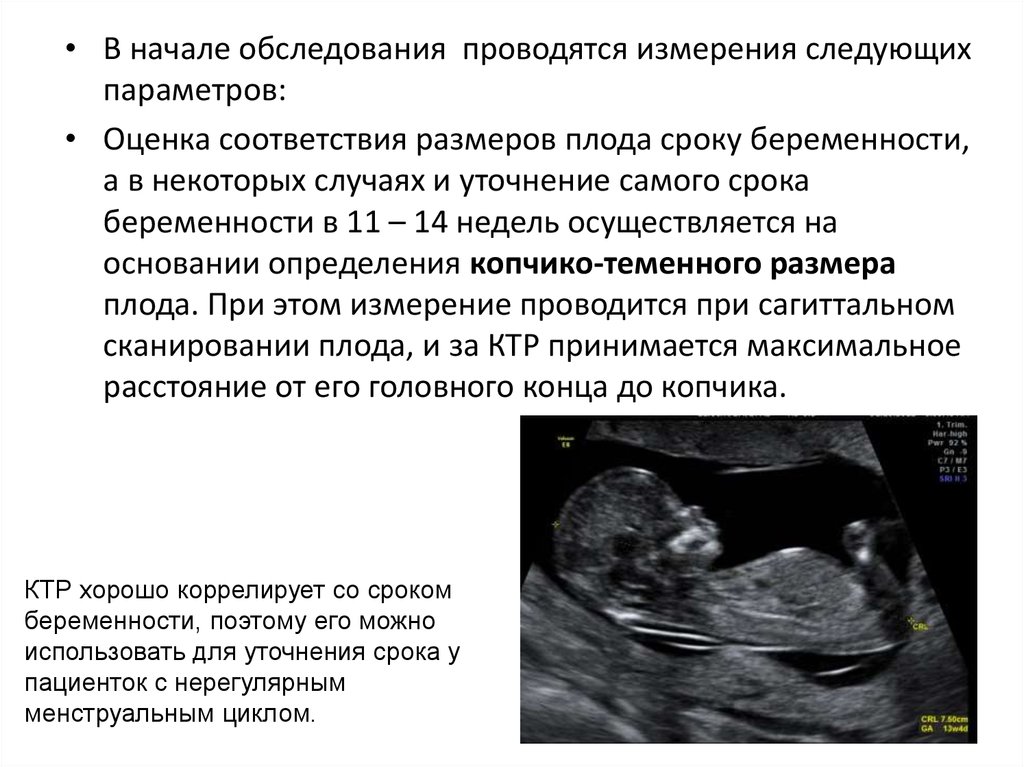 Ктр 4 недель. КТР плода на 12 неделе беременности. Копчиково-теменной размер плода в 12 недель норма. КТР эмбриона по неделям беременности. УЗИ 12 недель беременности КТР.