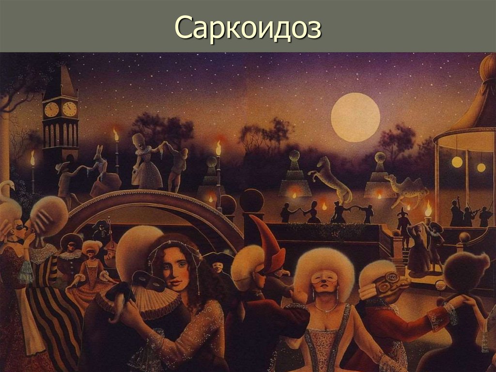 Саркоидоз