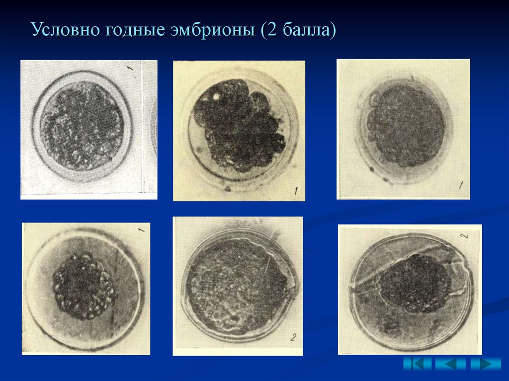 5 дневные эмбрионы. Эмбрион 2вв. Эмбрионы морфология 4вв. Эмбрион 2вв на 5 день расшифровка. 2 BB качество эмбриона.