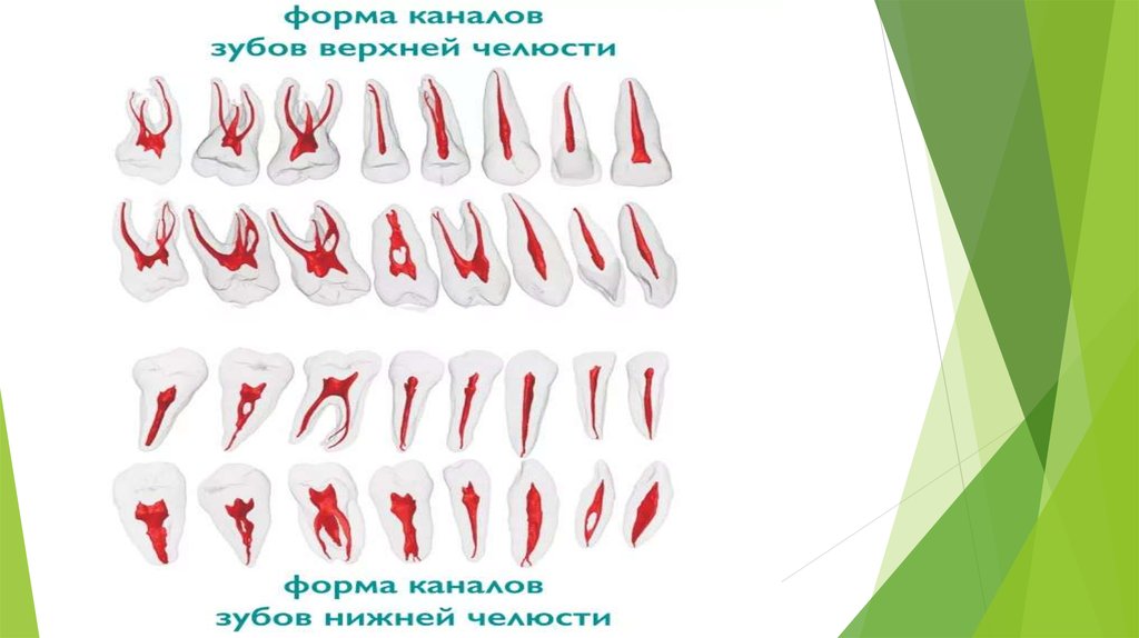 37 зуб каналы. Форма для канала.