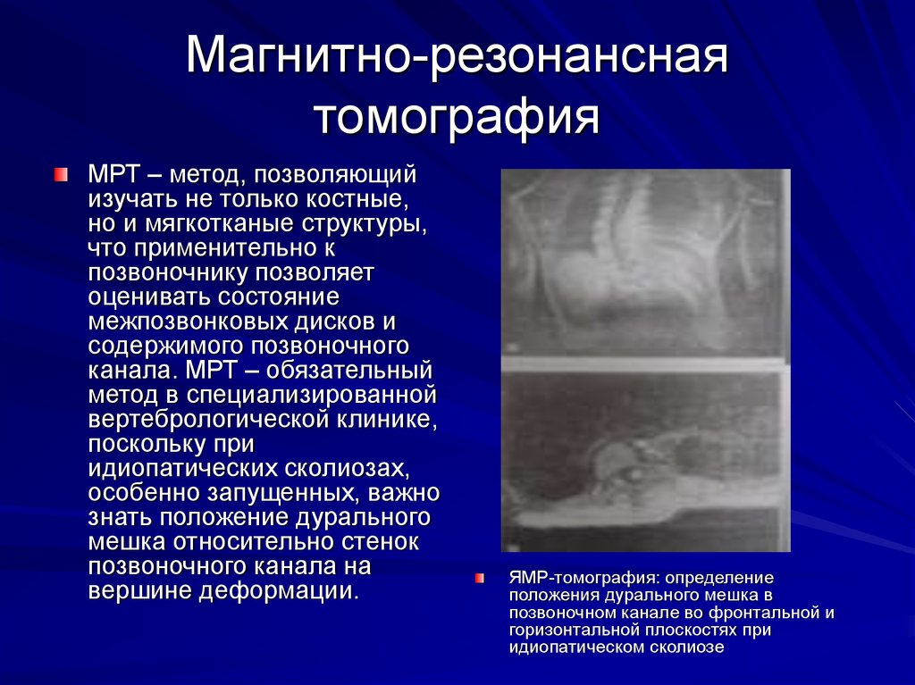 Магнитно резонансная томография презентация