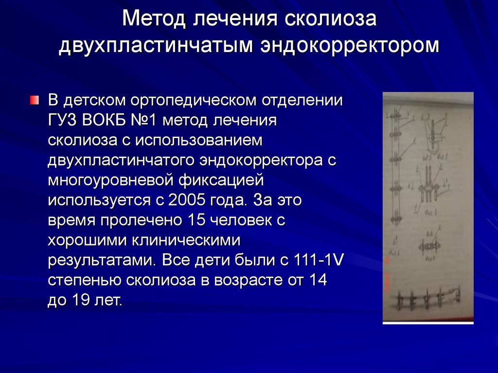 Профилактика сколиоза презентация