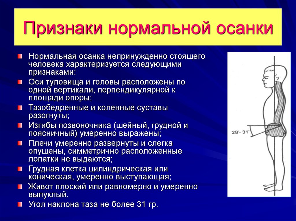 Осанка презентация для детей