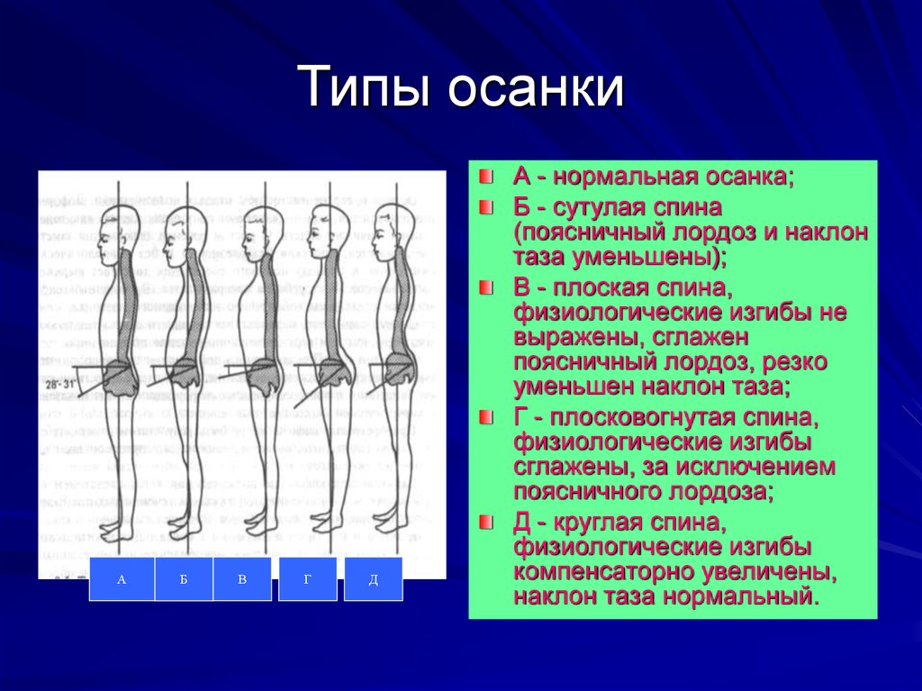 Рассмотрите рисунки 1 4 с изображением типов осанок человека как называют нарушение осанки