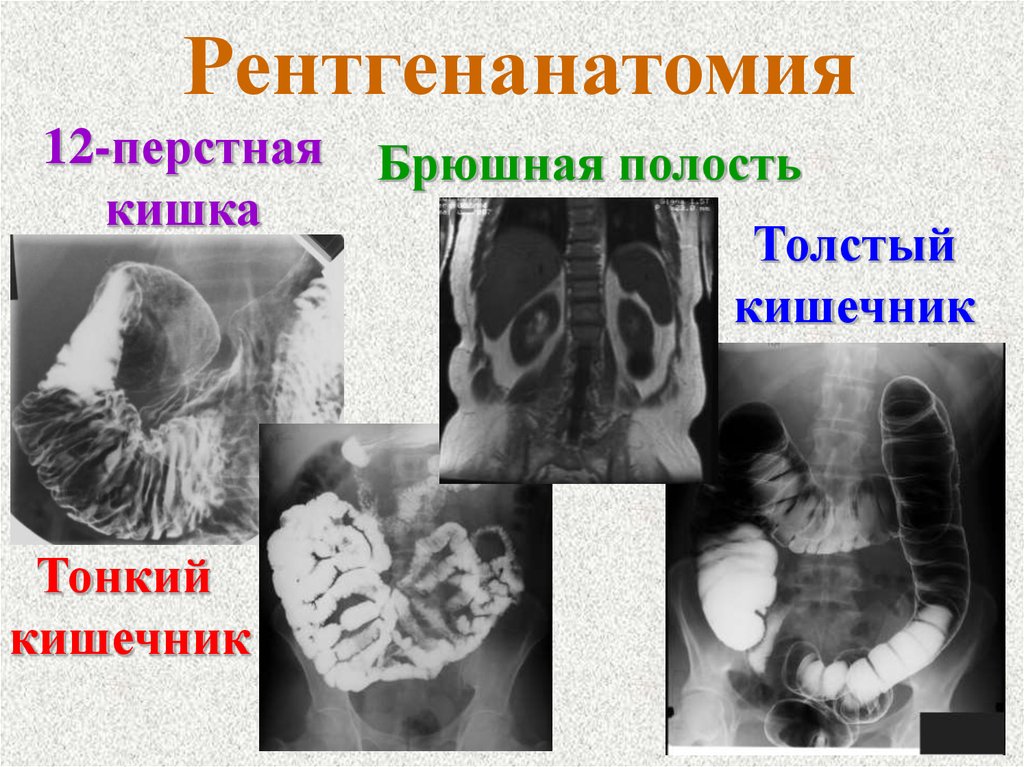 Рентгенанатомия