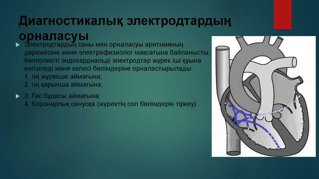 Диагностикалық электродтардың орналасуы