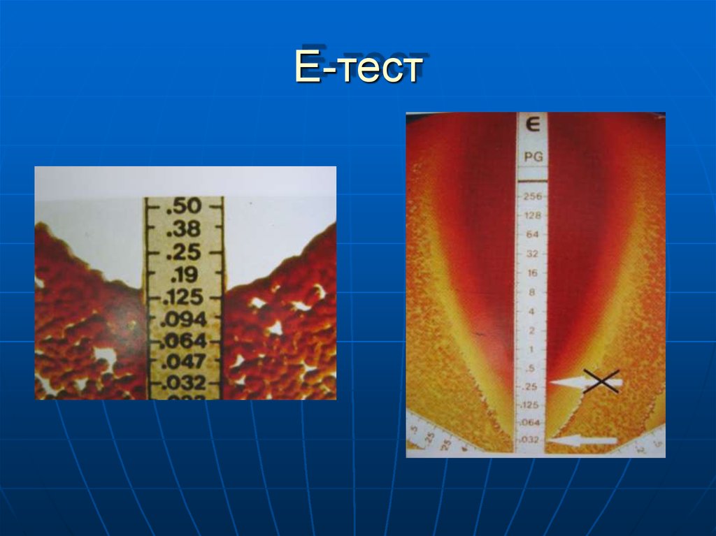 Е тест. Е тест микробиология. Шкала МПД-Д. Е-тесты купить. Koh тест микробиология.