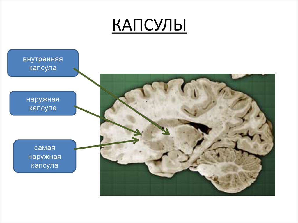 Внутренняя капсула. Самая наружная капсула конечный мозг. Внутренняя капсула конечного мозга. Базальные ядра наружная капсула. Внутренняя капсула конечный мозг латынь.