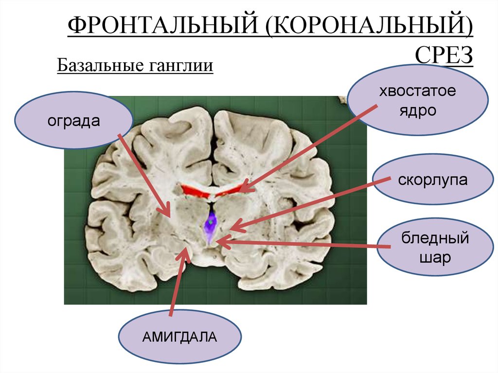 Изменение в базальных отделах. Базальные ганглии головного мозга анатомия. Бледный шар скорлупа хвостатое ядро. Ядра базальных ганглиев. Бледный шар анатомия.