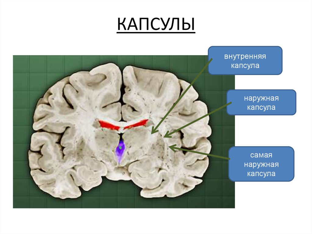 Внутренняя капсула. Наружная капсула конечного мозга. Внутренняя капсула конечного мозга. Топография внутренней капсулы мозга. Наружная и внутренняя капсула конечного мозга.