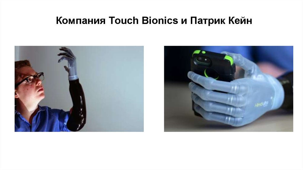 Компания тач. Touch Bionics. Головной передатчик Advanced Bionics. Aqua Case Advanced Bionics. Touch компания.