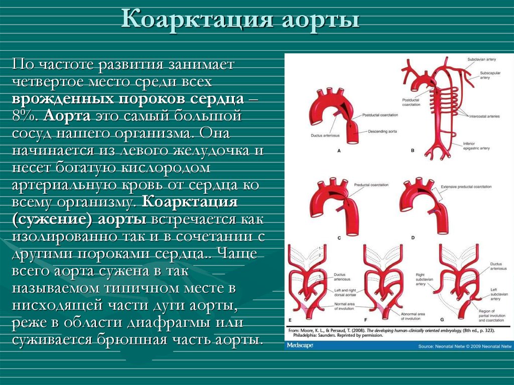 Аорта клинические рекомендации