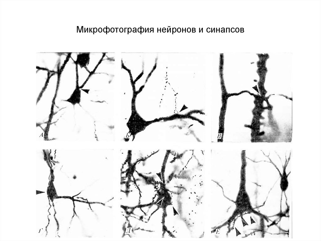 Микрофотография нейронов и синапсов