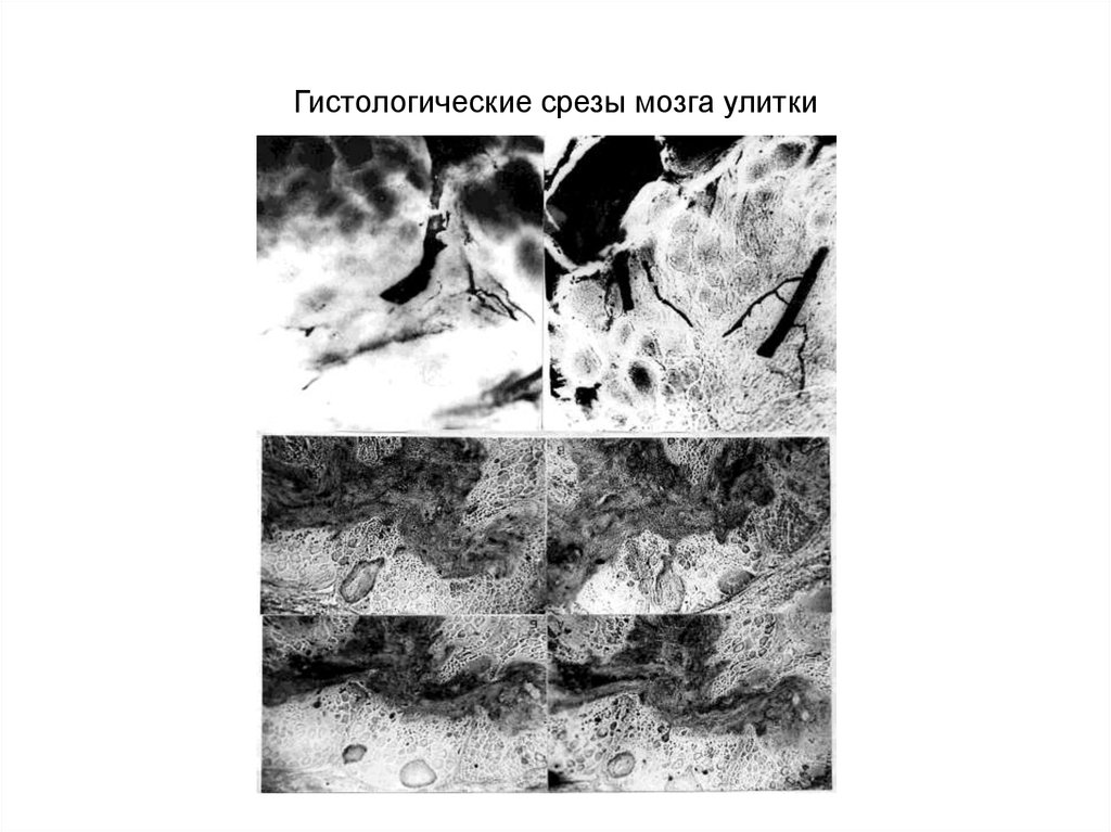 Гистологические срезы мозга улитки