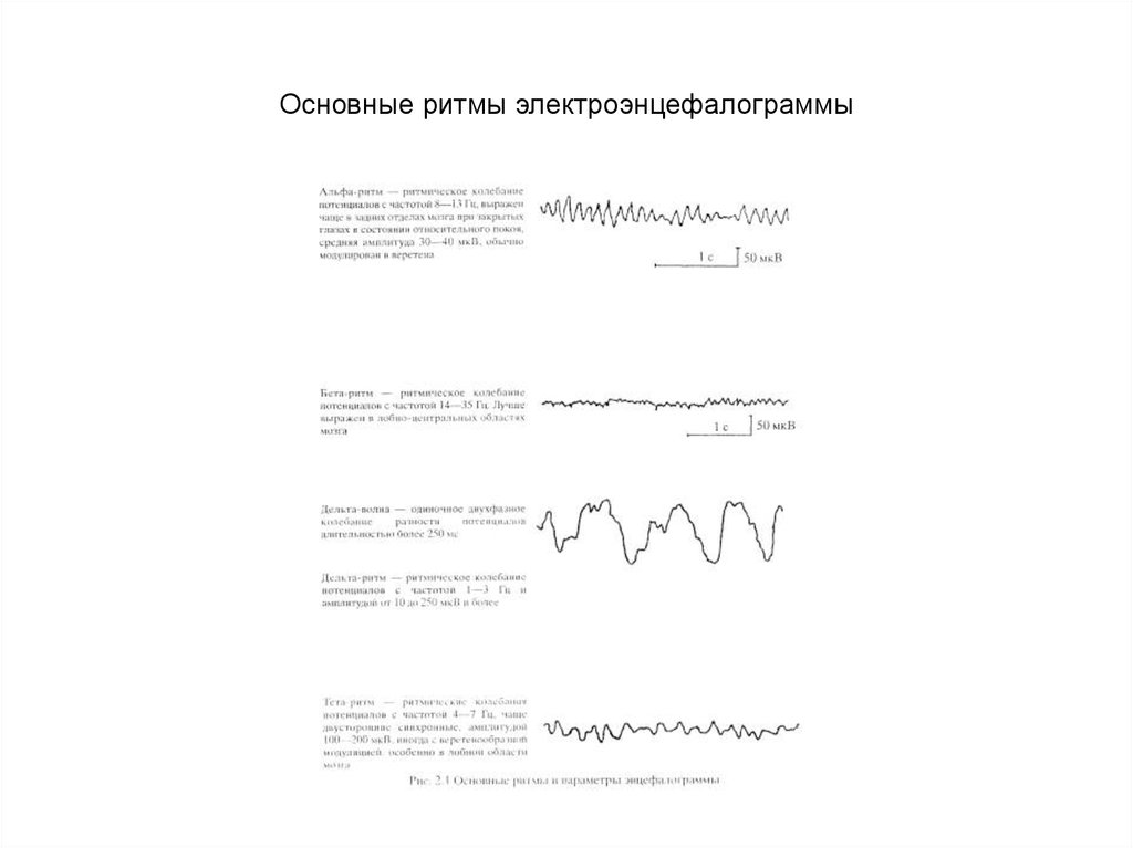 Основные ритмы электроэнцефалограммы