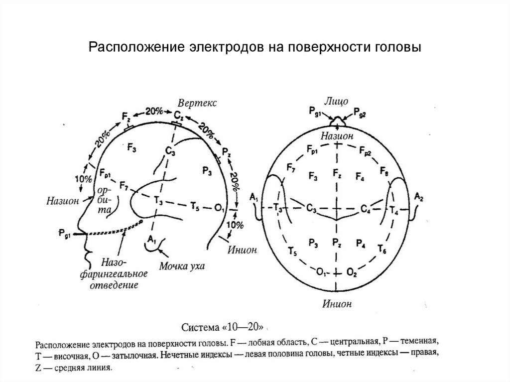 Схема 10 20 наложение электродов