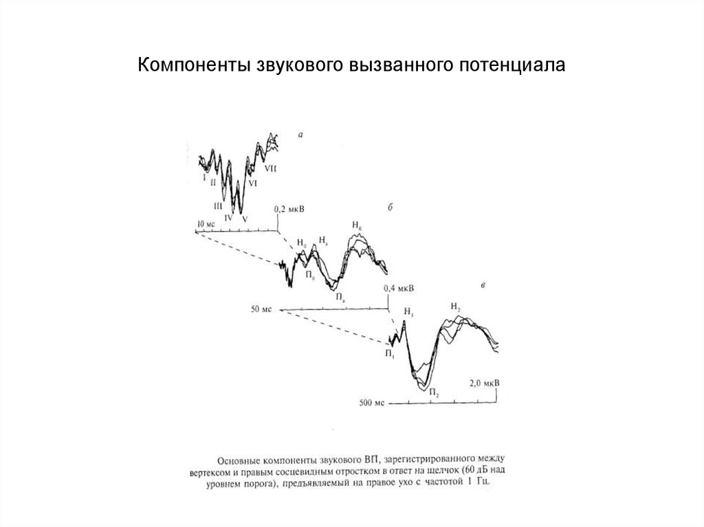 Компоненты звукового вызванного потенциала