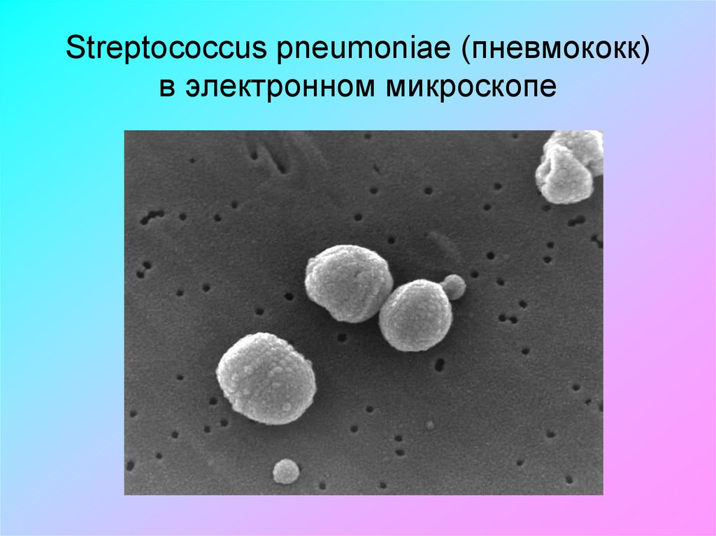 Streptococcus pneumoniae. Пневмококк diplococcus. Пневмококк электронная микроскопия. Ланцетовидные диплококки.