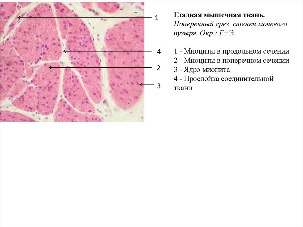 Ткани стенкам. Гладкая мышечная ткань стенки мочевого пузыря препарат. Гладкая мышечная ткань стенки мочевого пузыря гистология. Гладкая мышечная ткань срез стенки мочевого пузыря. Гладкая мышечная ткань мочевого пузыря препарат гистология.