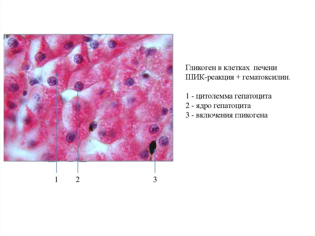 Клетки печени. Общая морфология клетки печени. Общая морфология клетки печени аксолотля. Включения гликогена в клетках печени аксолотля препарат. Включения гликогена в клетках печени Шик реакция.