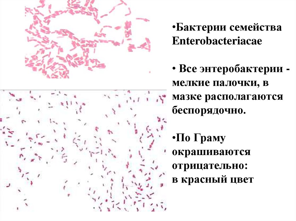 Полиморфная палочка в мазке