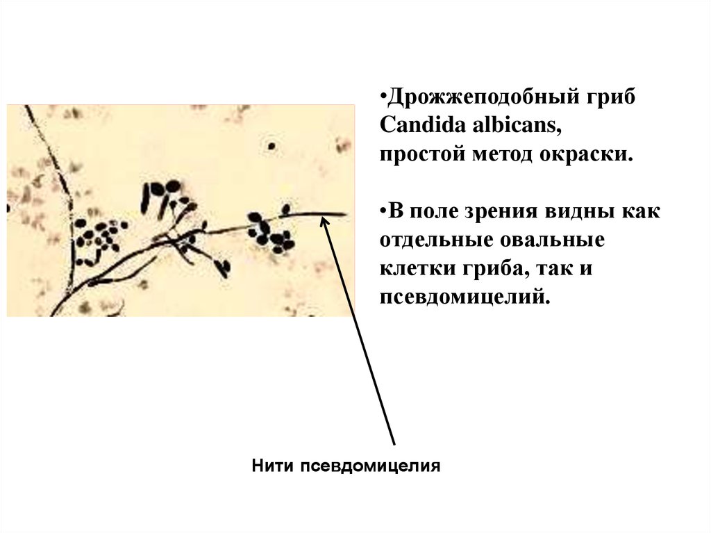 Схема кандида. Псевдомицелий гриба рода Candida. Дрожжеподобные грибки рода Candida. Грибы кандида микроскопия мазка. Грибы кандида микроскопия.