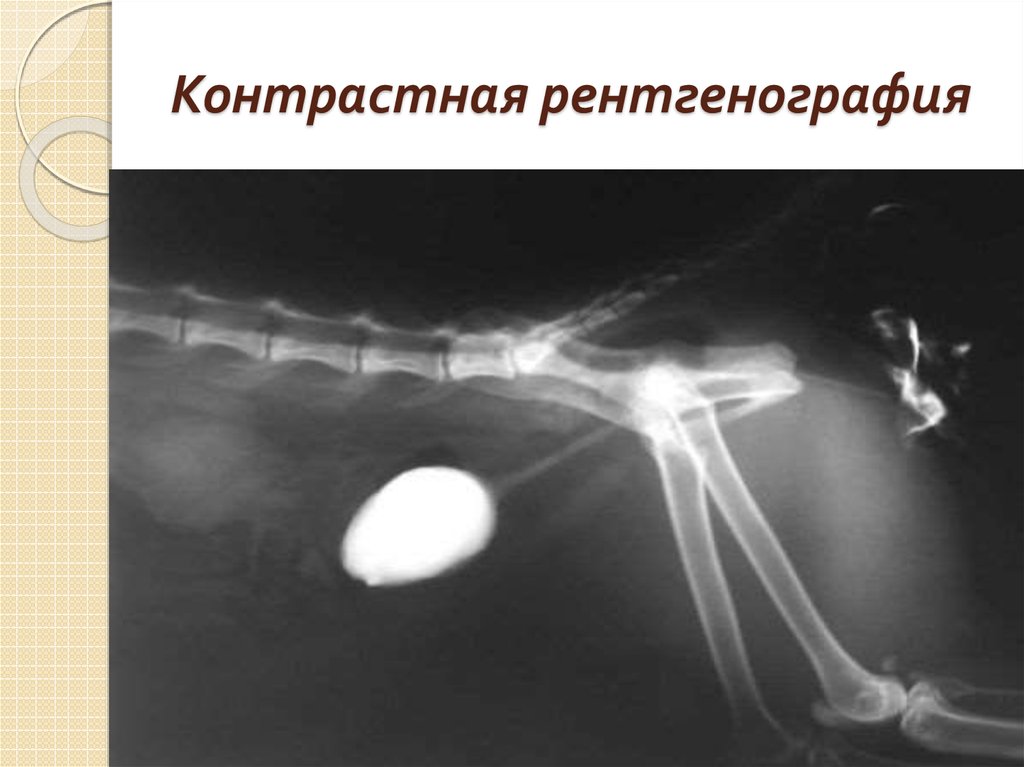 Без рентгенов. Контрастная рентгенография. Контрастная рентгеноскопия. Контрастнаяренггенография. Контрастная ренография это.