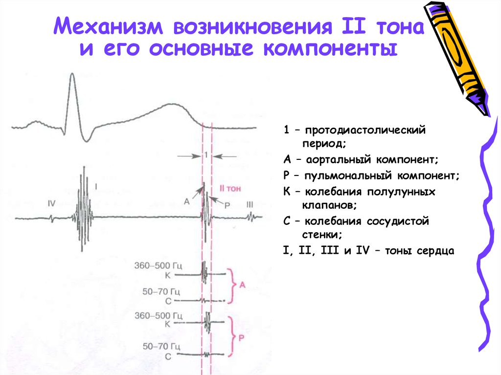 Механизм возникновения. Механизм возникновения 2 тона. Тоны сердца механизм их возникновения. Механизм образования 2 тона сердца. Механизм возникновения систолического тона.