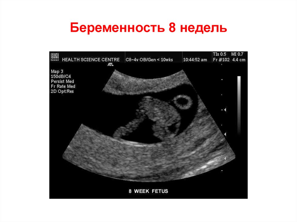 Симптомы 8 недели