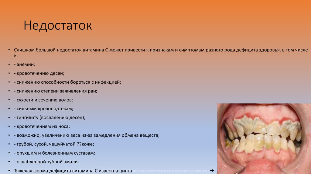 Недостаток