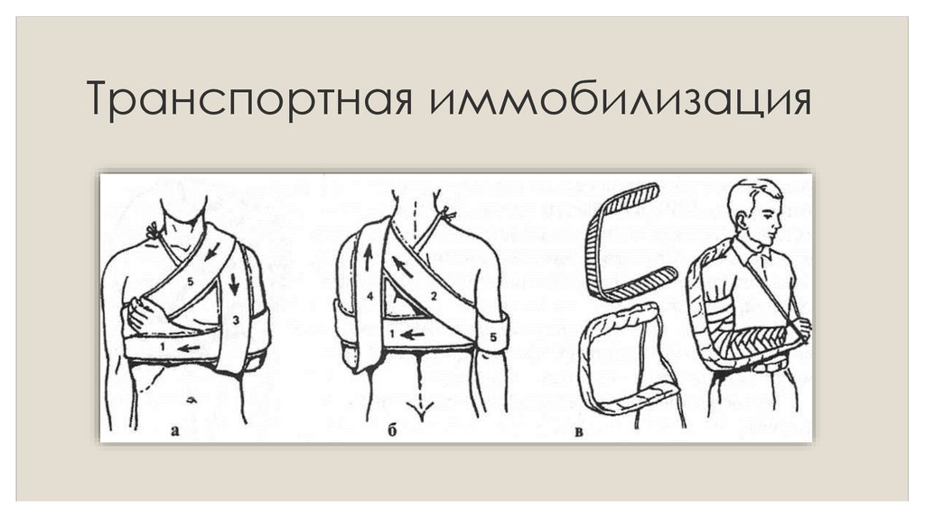 Презентация на тему иммобилизация и транспортировка пострадавших