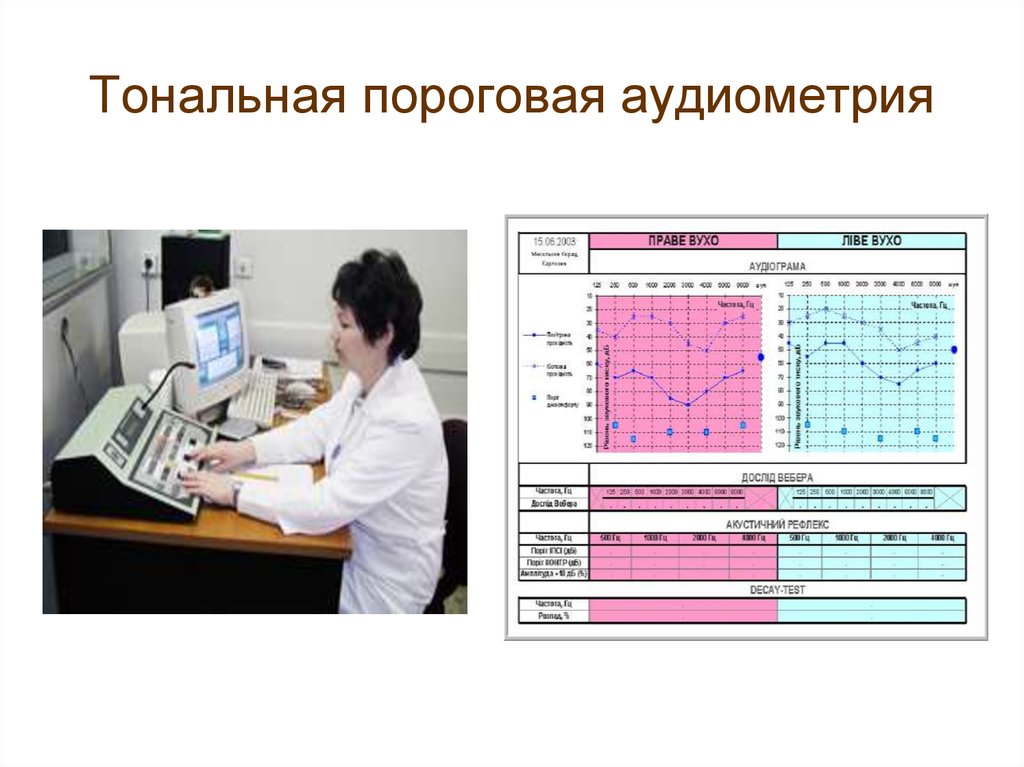 Аудиометрия это. Аудиометрия является методом исследования. Тональная пороговая аудиометрия с тестом Вебера. Тональная пороговая аудиометрия методика. Исследование слуха: тональная и речевая аудиометрия,.