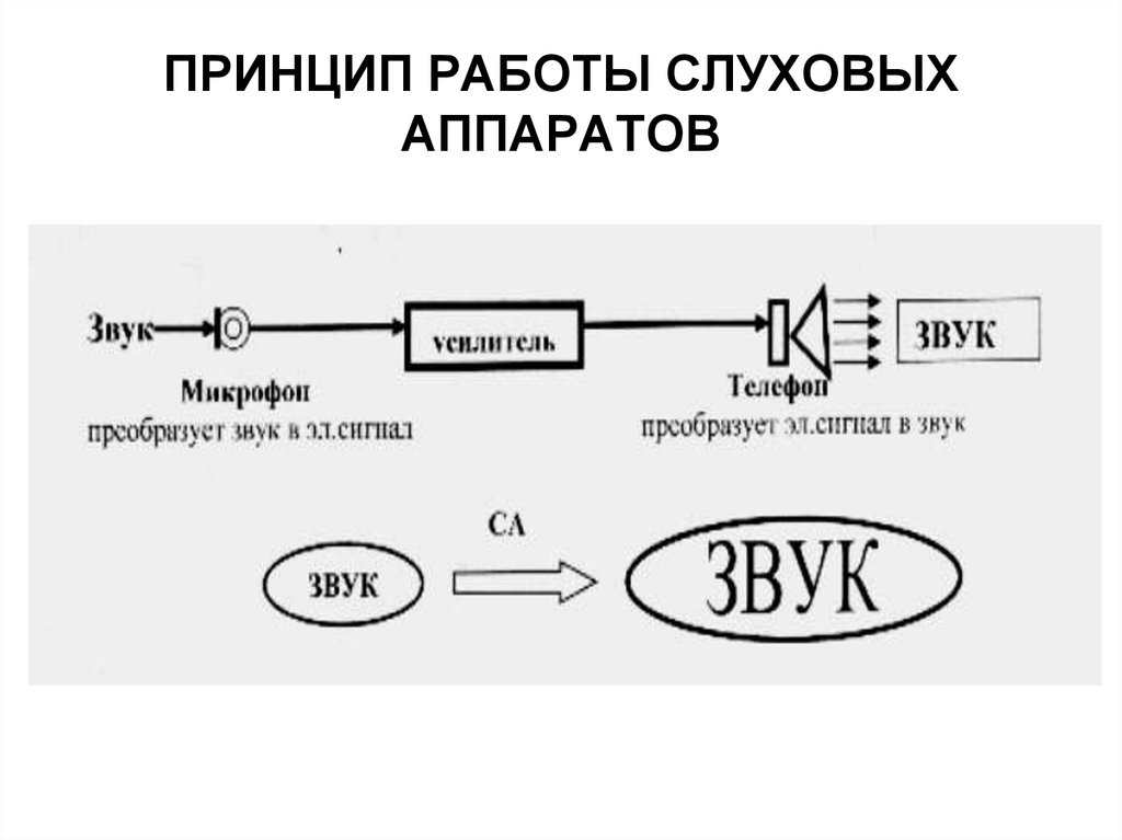 Схема слухового аппарата