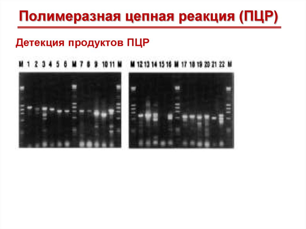 Детекция это. Метод детекции результата ПЦР. Детекция ПЦР продукта это. Детекция продукта при ПЦР. Флуоресцентная детекция результатов ПЦР.