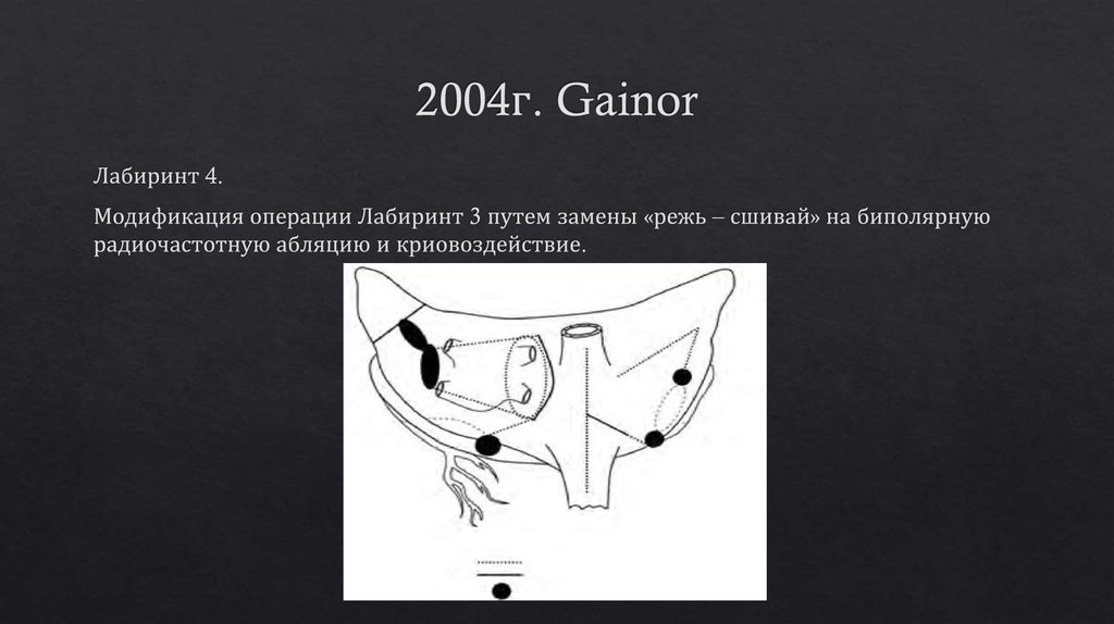 2004г. Gainor