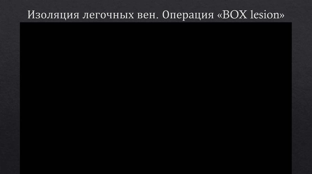 Изоляция легочных вен. Операция «BOX lesion»